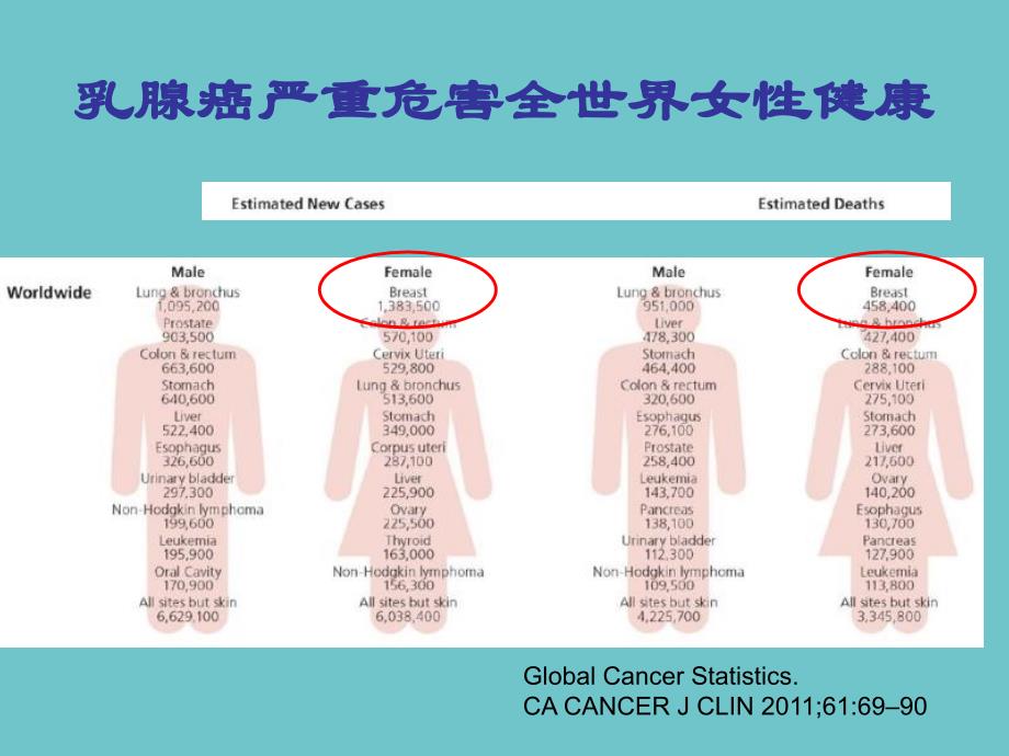 乳腺癌最新指南，理解、預(yù)防與應(yīng)對乳腺癌的核心要點(diǎn)